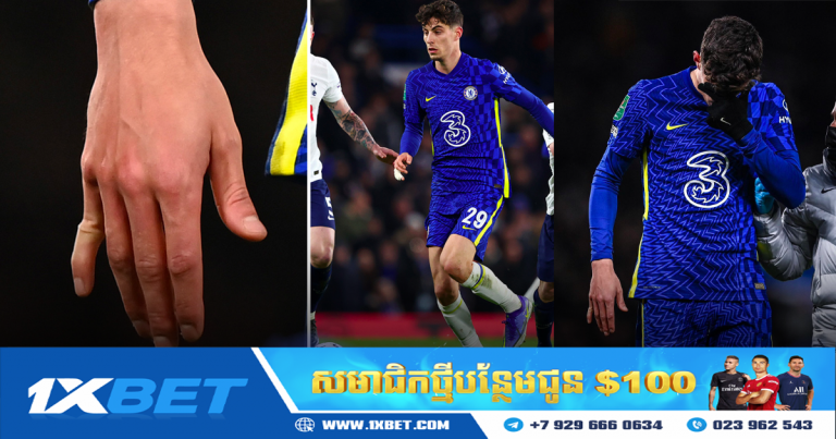 Havertz បានបាក់ម្រាមដៃ បន្ទាប់ពីអបអរគ្រាប់បាល់សម្រាប់ Chelsea