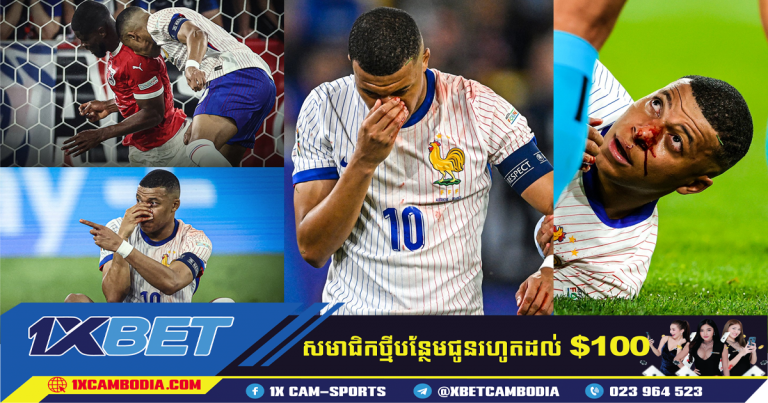 បារាំង ​បញ្ជាក់​ពី​របួស Kylian Mbappe ក្រោយ​បាក់​ច្រមុះ​
